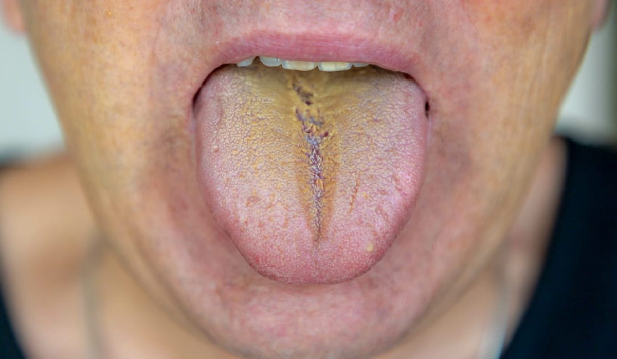 découvrez comment reconnaître et traiter efficacement les affections en dermatologie buccale pour préserver la santé de votre bouche.